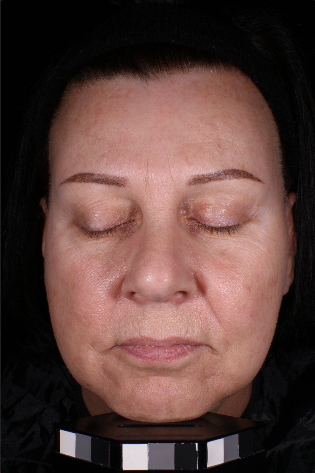 Face after 4 weeks use of product Woman's face with improved appearance of wrinkles, fine lines, pores, redness, and elasticity and even skin tone