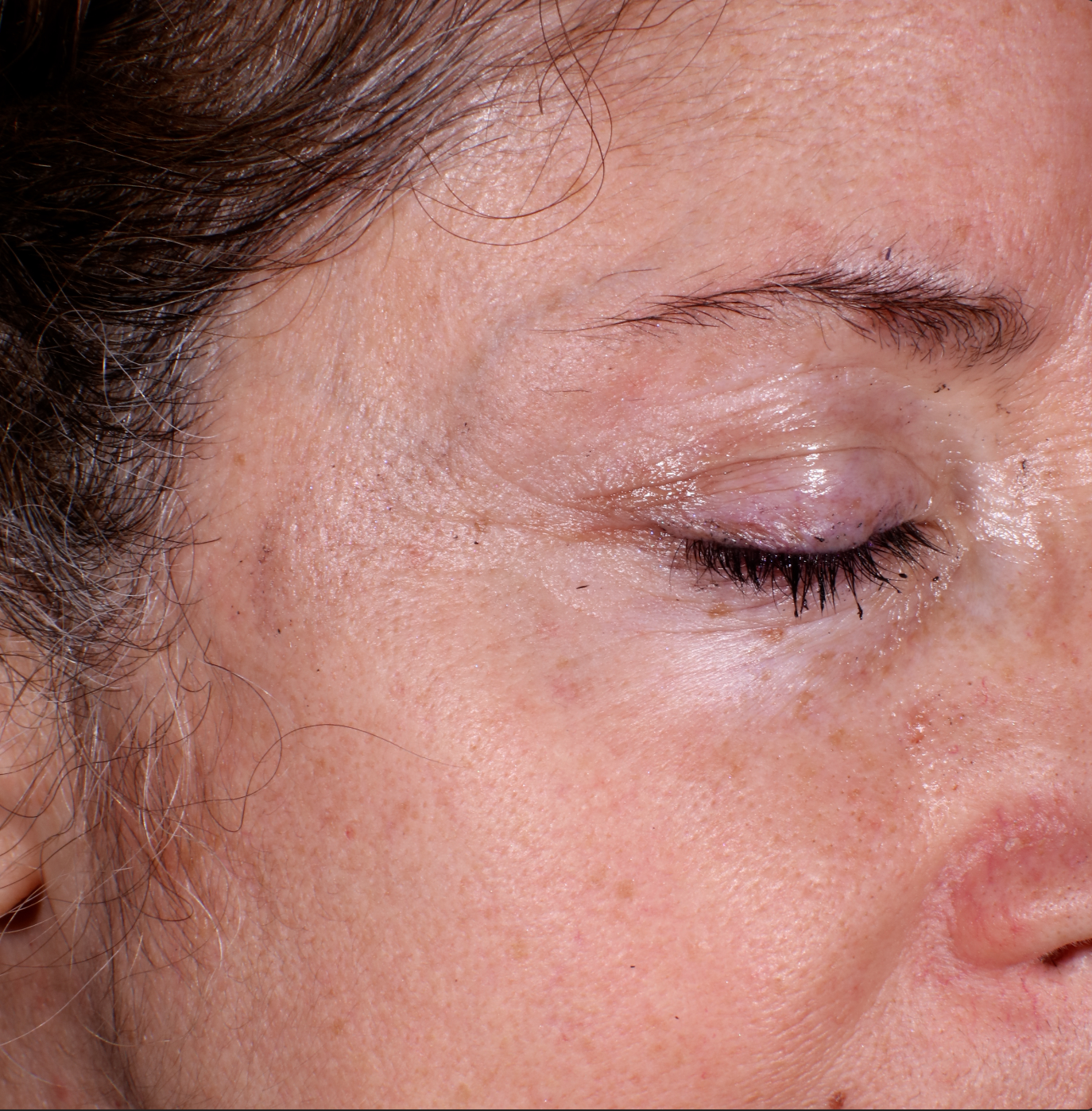 40+ year old woman's skin after treatment of 4 weeks of IDEO Skin Memory Serum After photo of woman with better skin