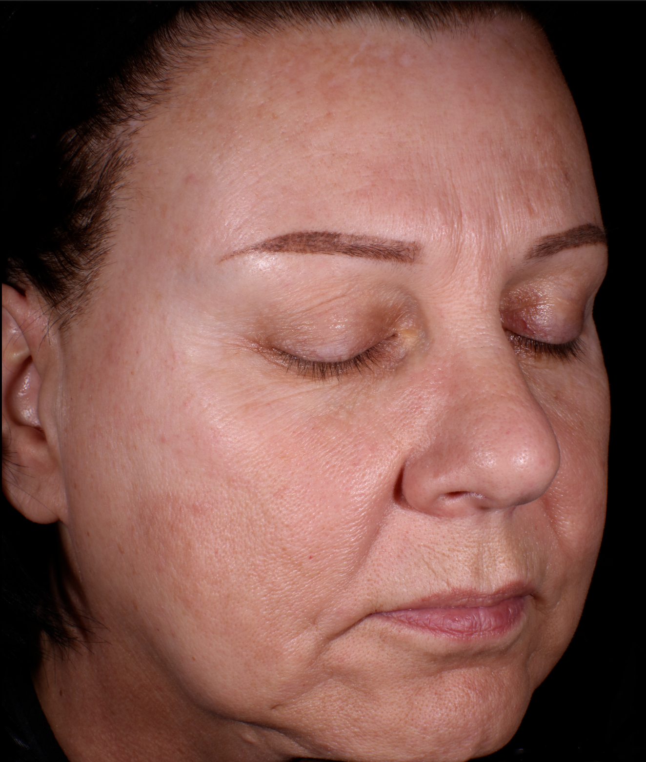 40+ year old woman whose skin has been improved by 4 weeks of usage of anti-aging skin memory serum After